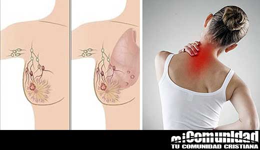 !Muchas mujeres los ignoran! Signos y síntomas que te anuncian que puede tener riesgo de cáncer de mama