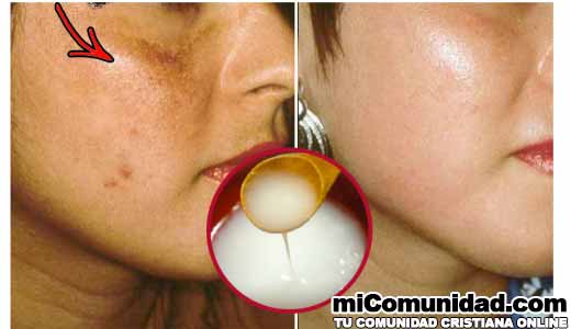 Cómo preparar una crema natural para blanquear el cutis en poco tiempo